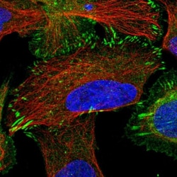 TRIP6 Antibody, Novus Biologicals:Antibodies:Primary Antibodies